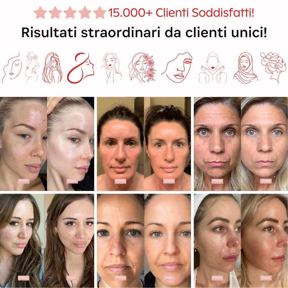 Maschere Aurealface™