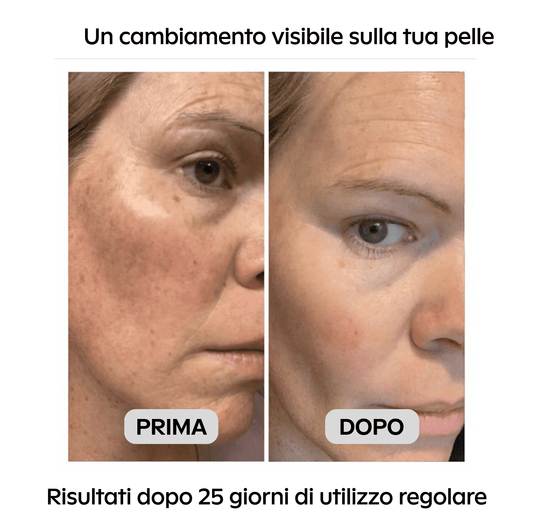 Sérum à la niacinamide